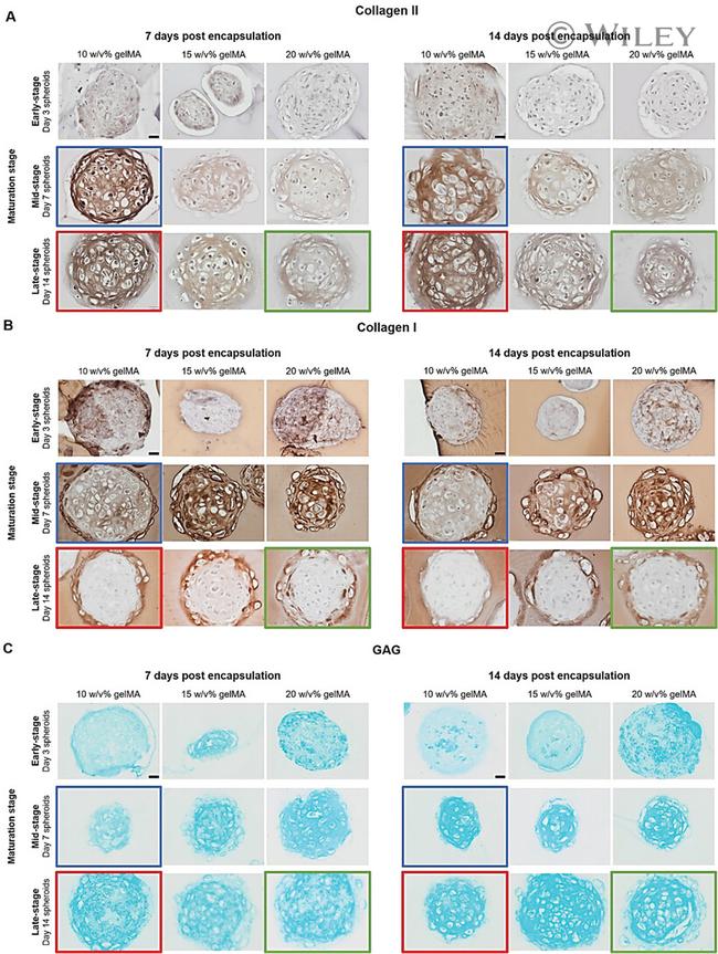 Collagen X Antibody in Immunohistochemistry (IHC)