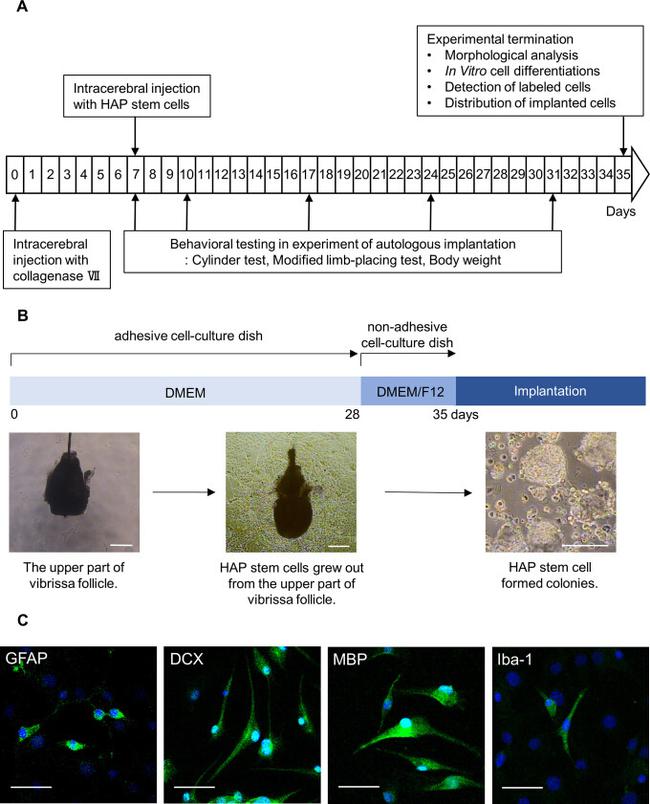 GFAP Antibody in Immunocytochemistry (ICC/IF)