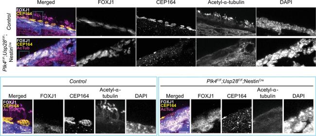 FOXJ1 Antibody in Immunohistochemistry (IHC)