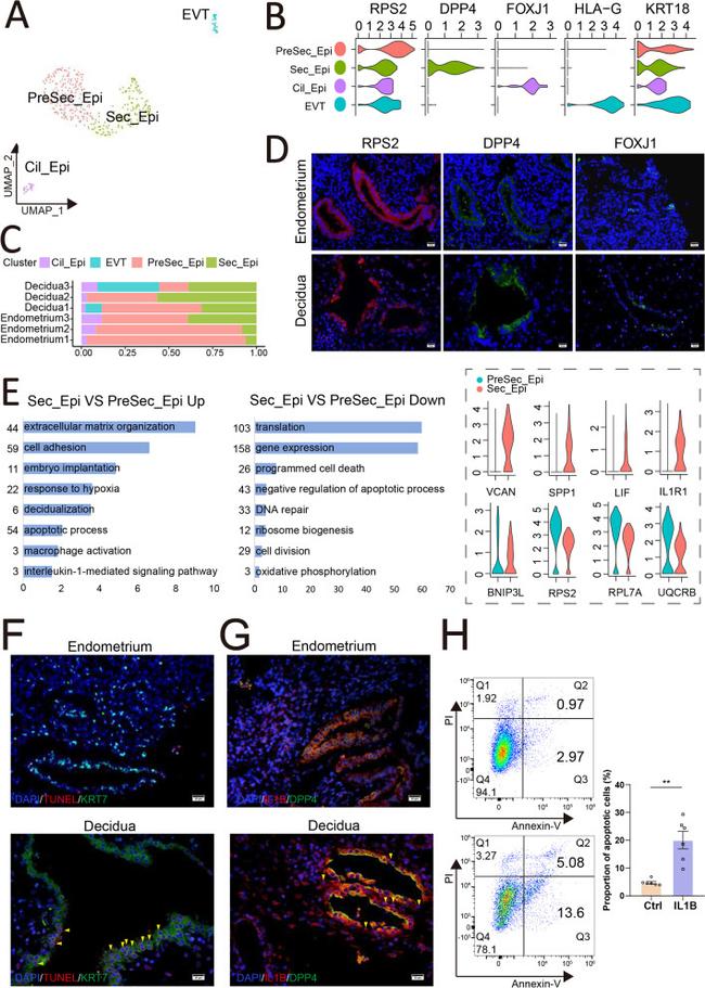 FOXJ1 Antibody in Immunohistochemistry (IHC)