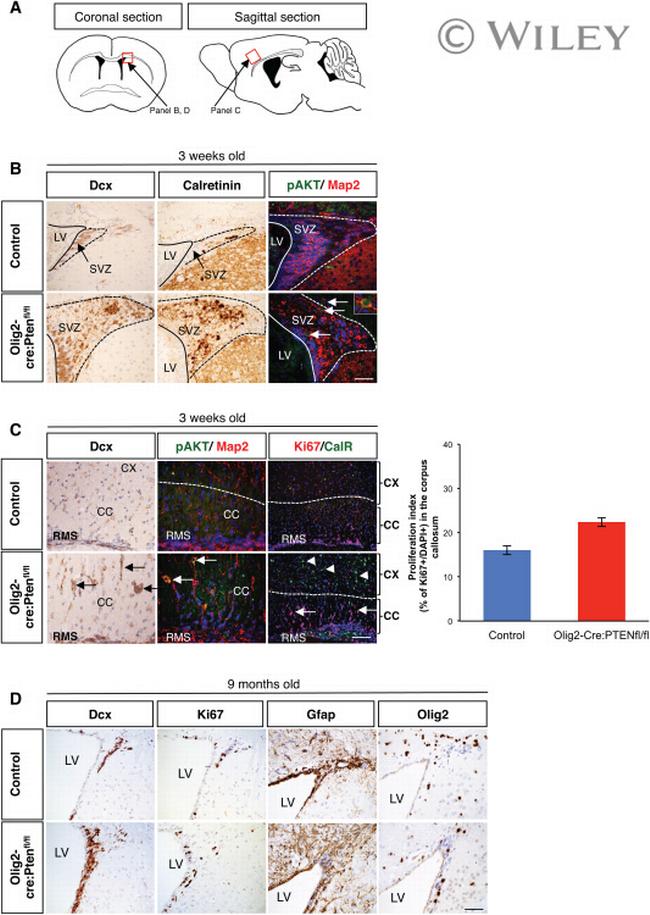 Calretinin Antibody in Immunohistochemistry (IHC)