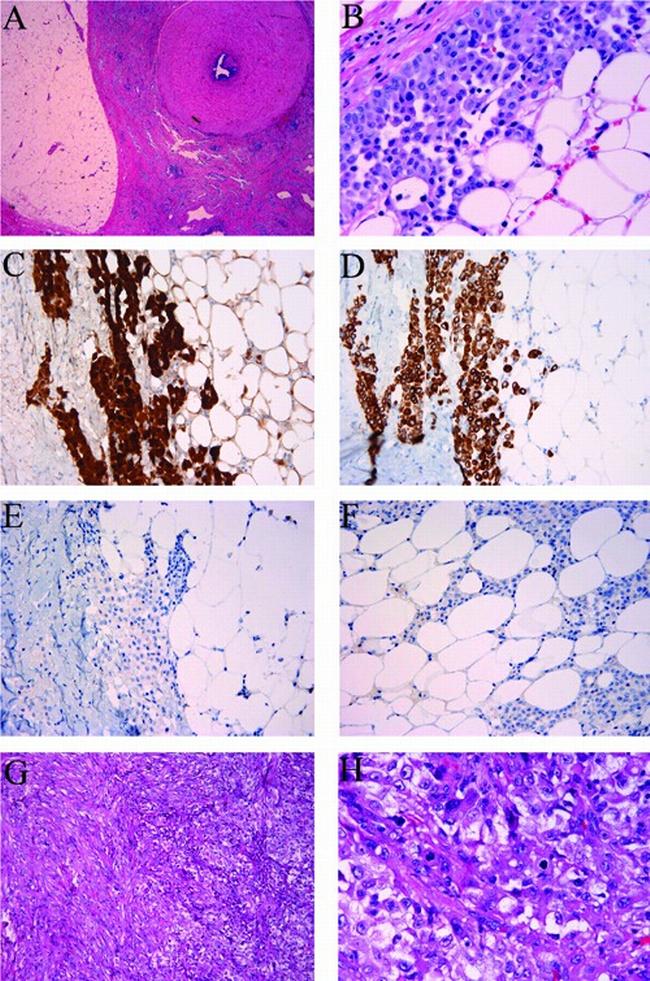 Calretinin Antibody in Immunohistochemistry (IHC)