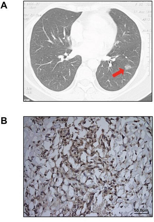 Calretinin Antibody in Immunohistochemistry (IHC)