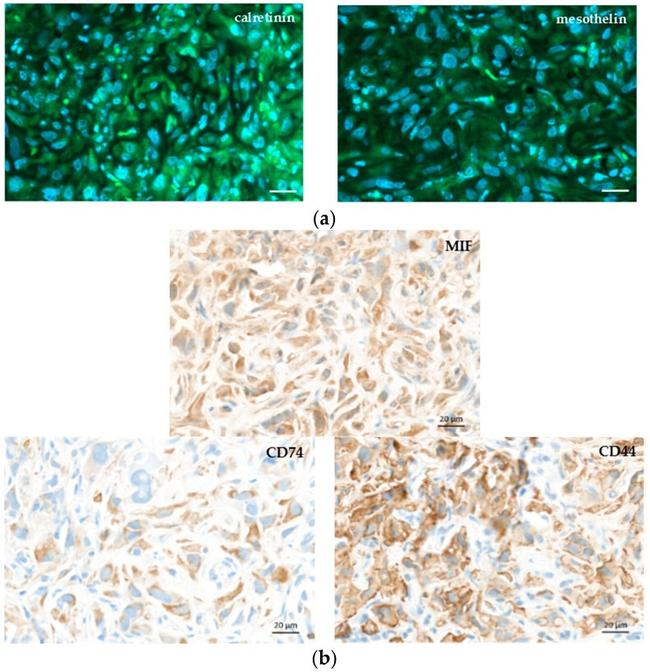 Calretinin Antibody in Immunohistochemistry (IHC)