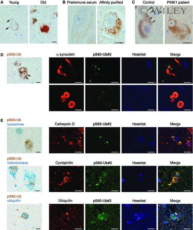 Alpha-synuclein Antibody in Immunohistochemistry (IHC)