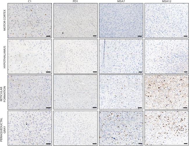 Alpha-synuclein Antibody in Immunohistochemistry (IHC)