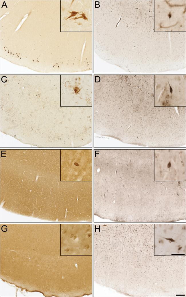 Alpha-synuclein Antibody in Immunohistochemistry (IHC)