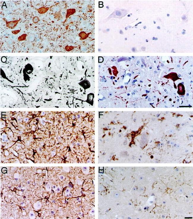 Alpha-synuclein Antibody in Immunohistochemistry (IHC)