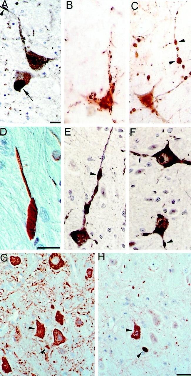 Alpha-synuclein Antibody in Immunohistochemistry (IHC)