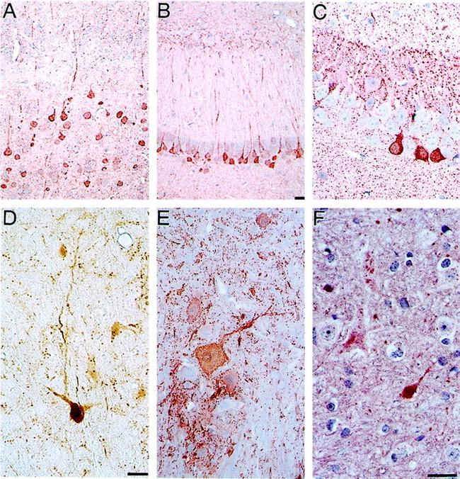 Alpha-synuclein Antibody in Immunohistochemistry (IHC)