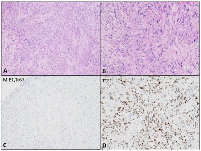 Nkx2.1 Antibody in Immunohistochemistry (IHC)