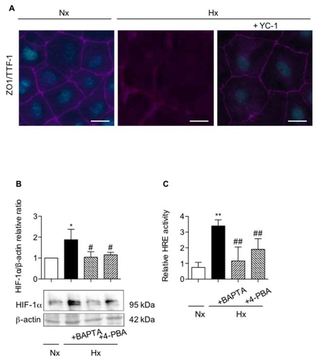 Nkx2.1 Antibody in Immunocytochemistry (ICC/IF)