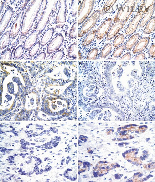 E-Cadherin Antibody in Immunohistochemistry (IHC)