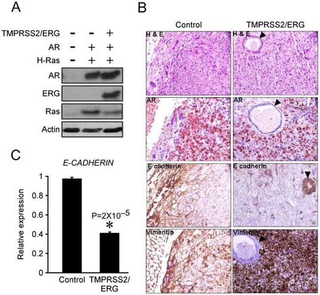 E-Cadherin Antibody in Immunohistochemistry (IHC)