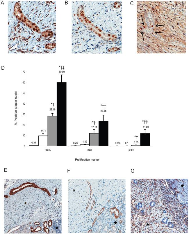 E-Cadherin Antibody in Immunohistochemistry (IHC)