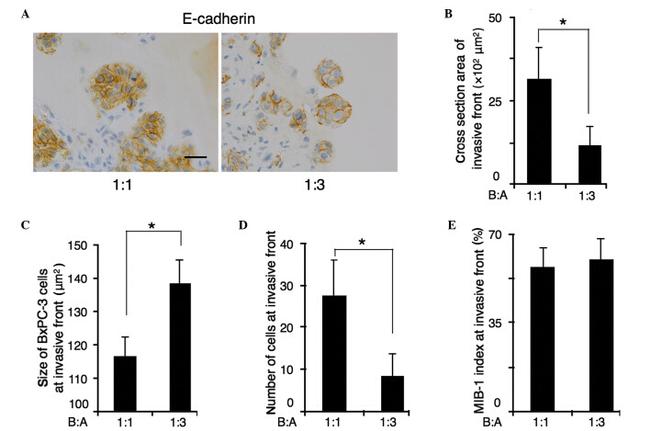 E-Cadherin Antibody in Immunocytochemistry (ICC/IF)