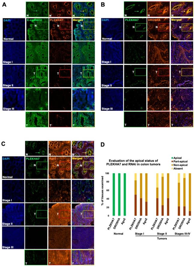 E-Cadherin Antibody in Immunohistochemistry (IHC)