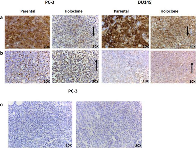 E-Cadherin Antibody in Immunohistochemistry (IHC)