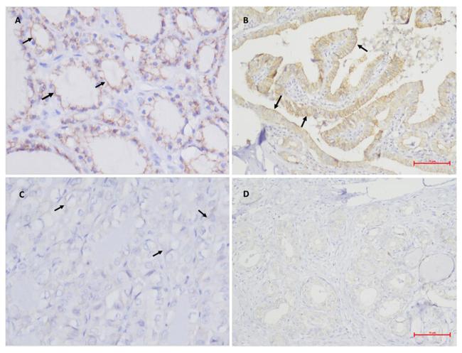 E-Cadherin Antibody in Immunohistochemistry (IHC)