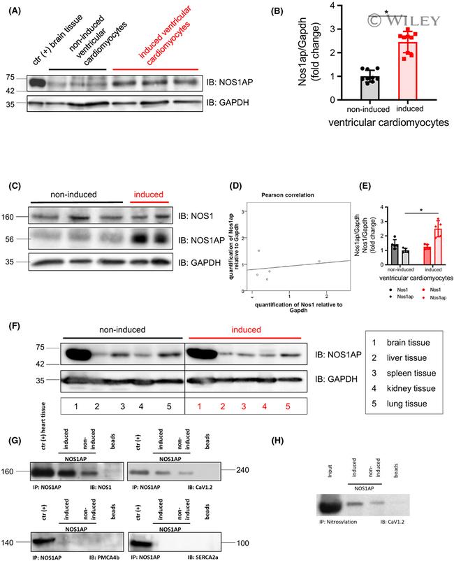 CaV1.2 Antibody in Western Blot (WB)