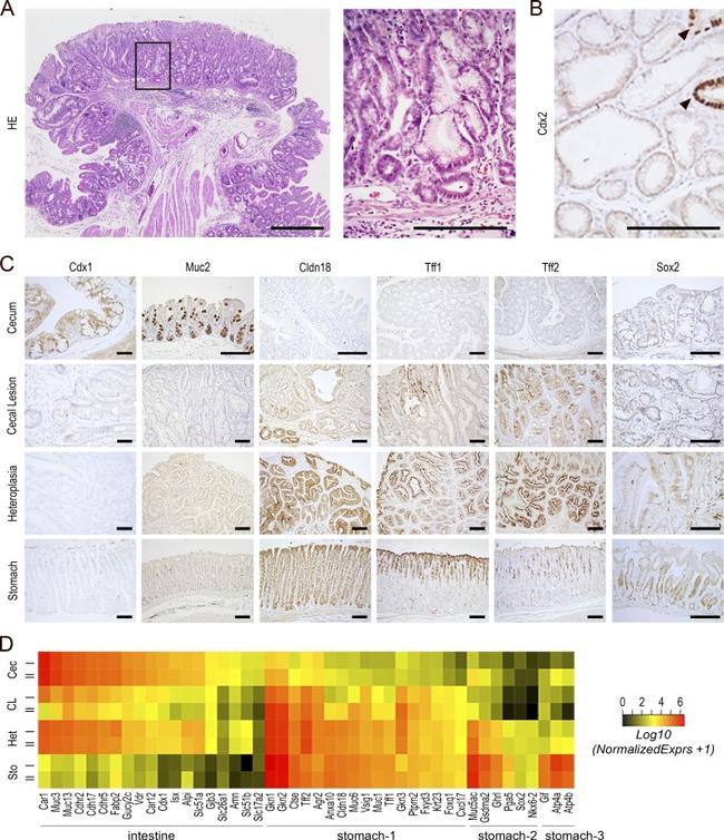 Claudin 18 Antibody in Immunohistochemistry (IHC)