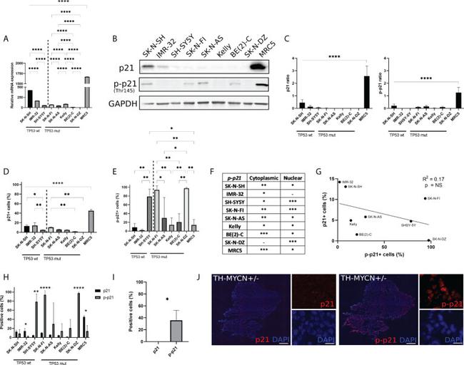 GAPDH Antibody in Western Blot (WB)