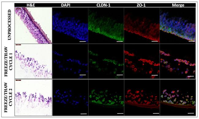 ZO-1 Antibody in Immunohistochemistry (IHC)