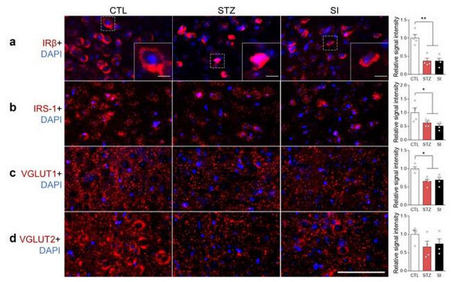 VGLUT1 Antibody in Immunohistochemistry (IHC)