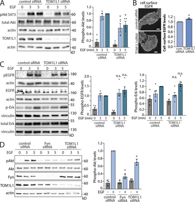 Phospho-AKT1 (Ser473) Antibody in Western Blot (WB)