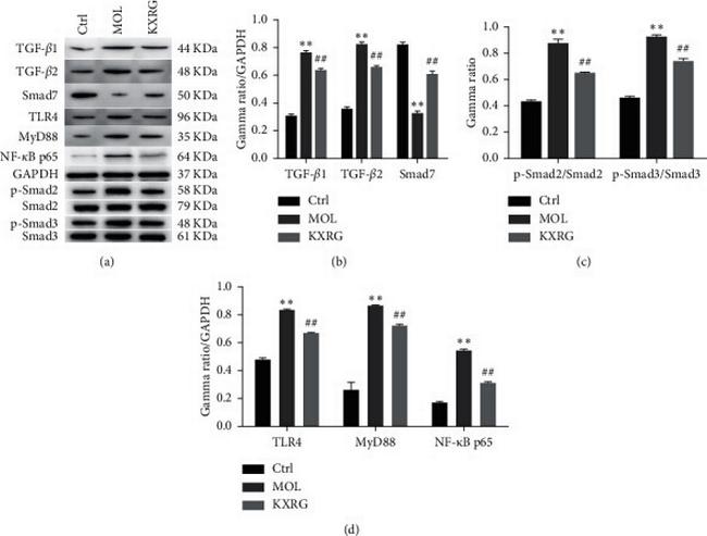 TLR4 Antibody in Western Blot (WB)