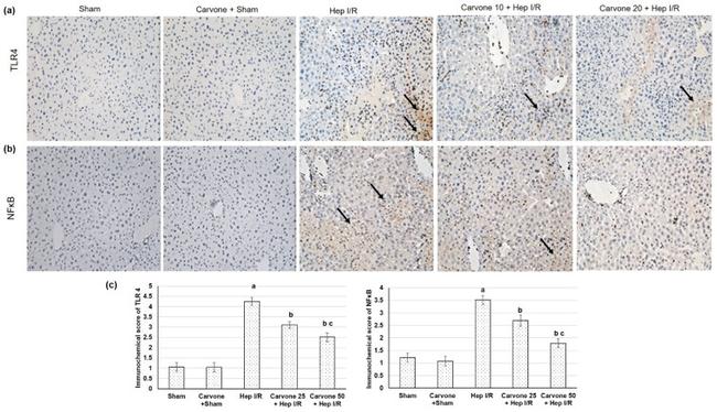 TLR4 Antibody in Immunohistochemistry (IHC)