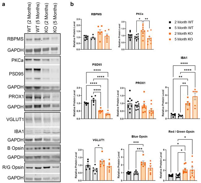 VGLUT1 Antibody in Western Blot (WB)