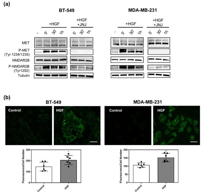 Phospho-NMDAR2B (Tyr1252) Antibody in Western Blot, Immunocytochemistry (WB, ICC/IF)