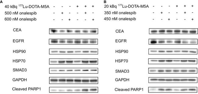 CD66e (CEA) Antibody in Western Blot (WB)