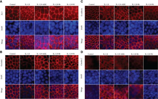 Claudin 2 Antibody in Immunocytochemistry (ICC/IF)