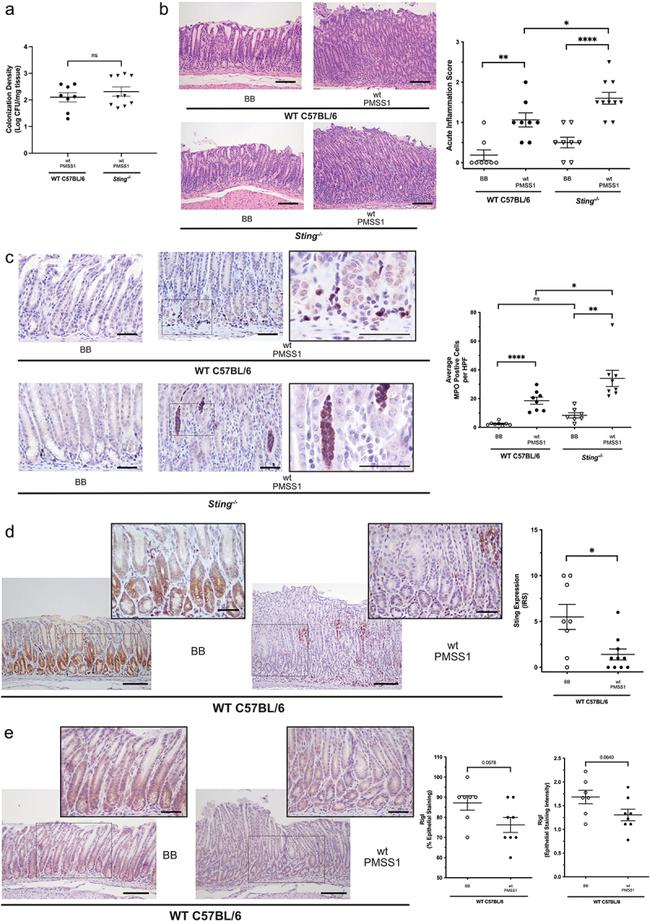 RIG-I Antibody in Immunohistochemistry (IHC)