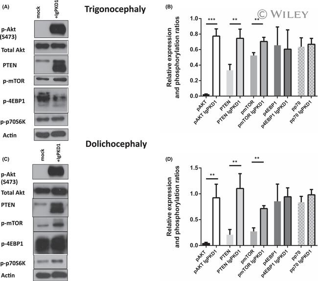 mTOR Antibody in Western Blot (WB)