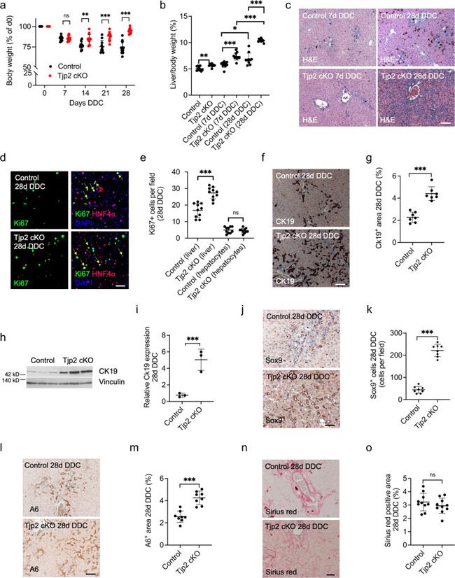 HNF4A Antibody in Immunohistochemistry (IHC)