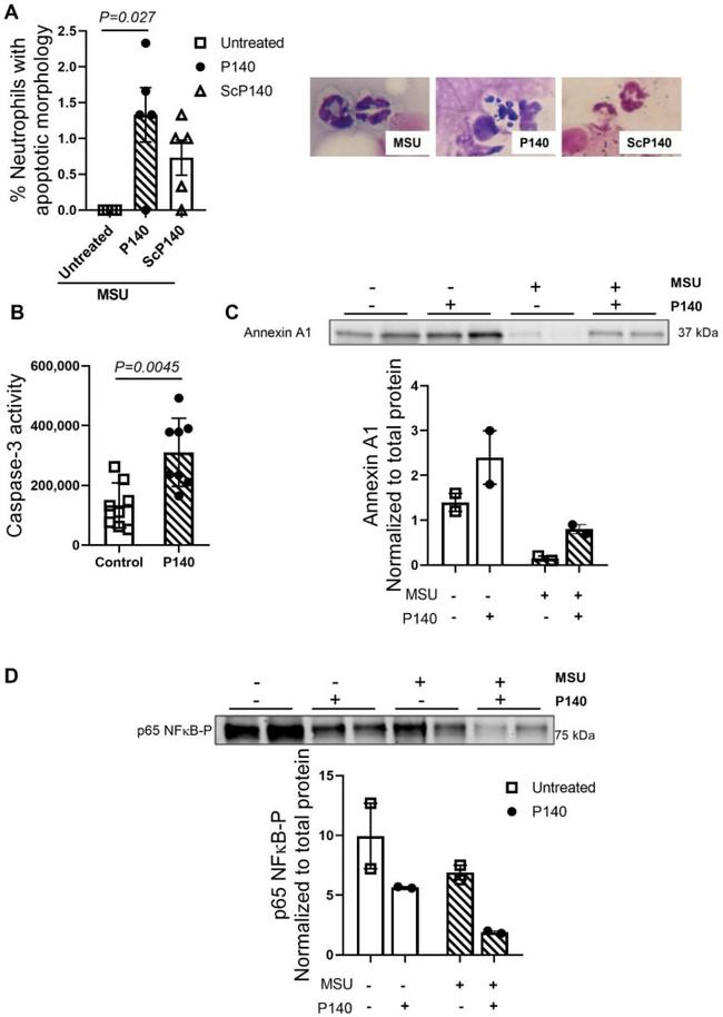 Annexin A1 Antibody in Western Blot (WB)