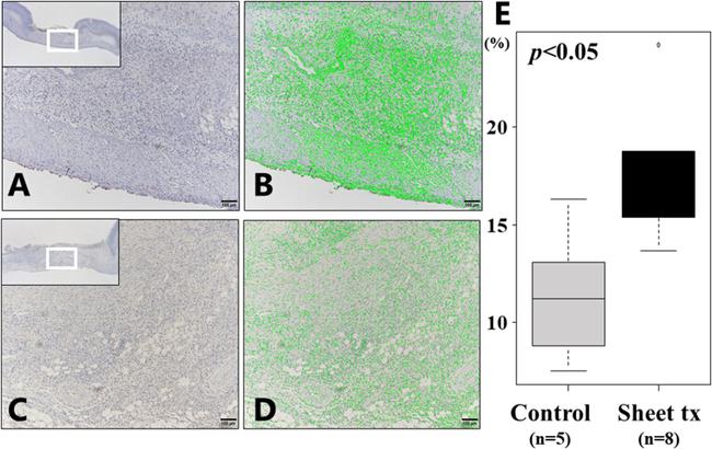 CD34 Antibody in Immunohistochemistry (IHC)