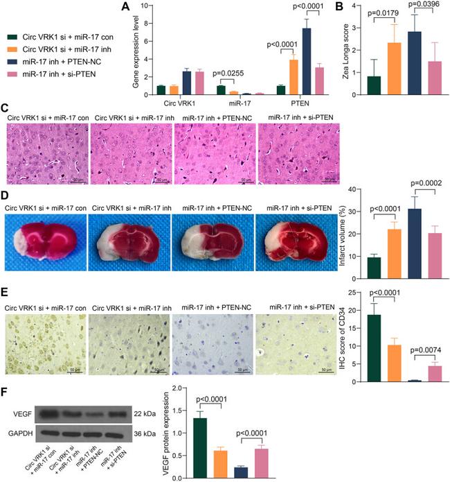 CD34 Antibody in Immunohistochemistry (IHC)