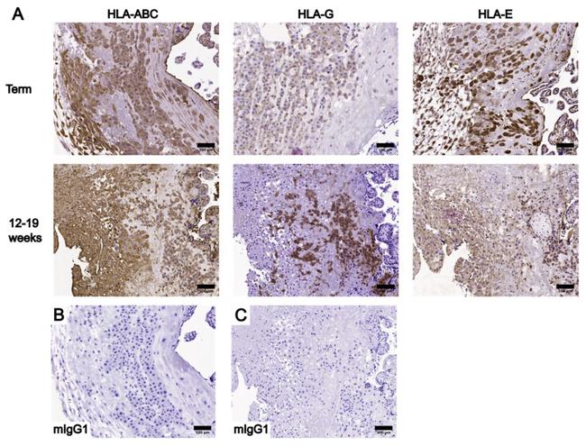 HLA-G Antibody in Immunohistochemistry (IHC)