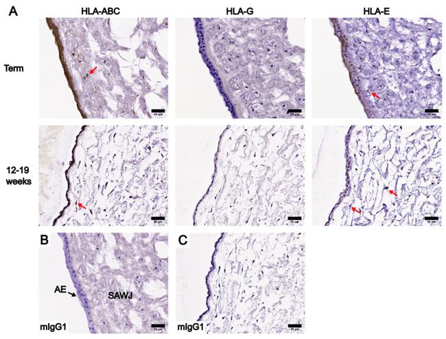 HLA-G Antibody in Immunohistochemistry (IHC)