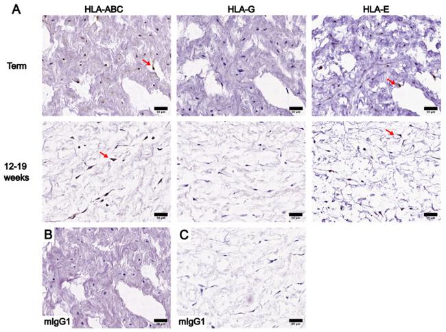 HLA-G Antibody in Immunohistochemistry (IHC)