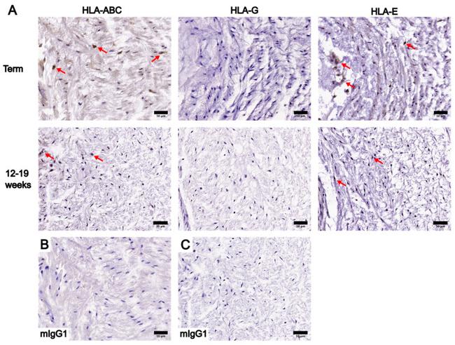 HLA-G Antibody in Immunohistochemistry (IHC)