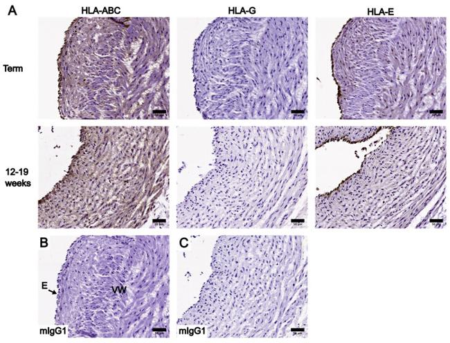 HLA-G Antibody in Immunohistochemistry (IHC)