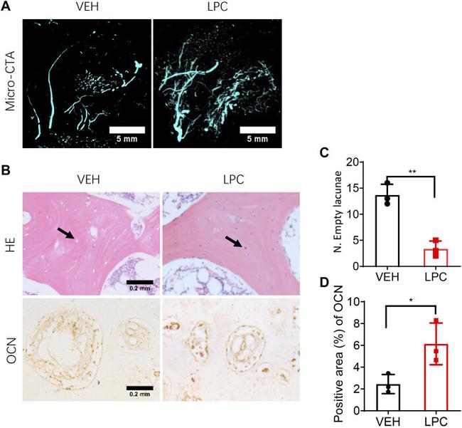 Osteocalcin Antibody in Immunohistochemistry (IHC)