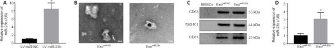 TSG101 Antibody in Western Blot (WB)