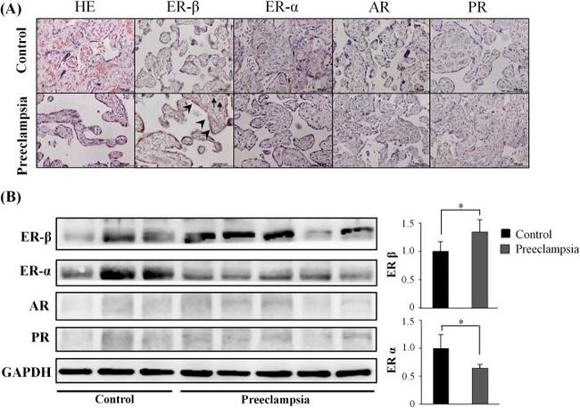 Estrogen Receptor alpha Antibody in Western Blot (WB)