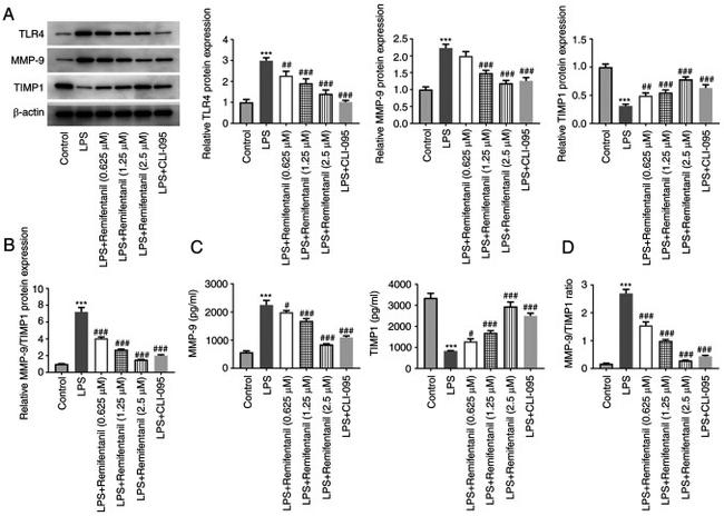 TIMP1 Antibody in Western Blot (WB)